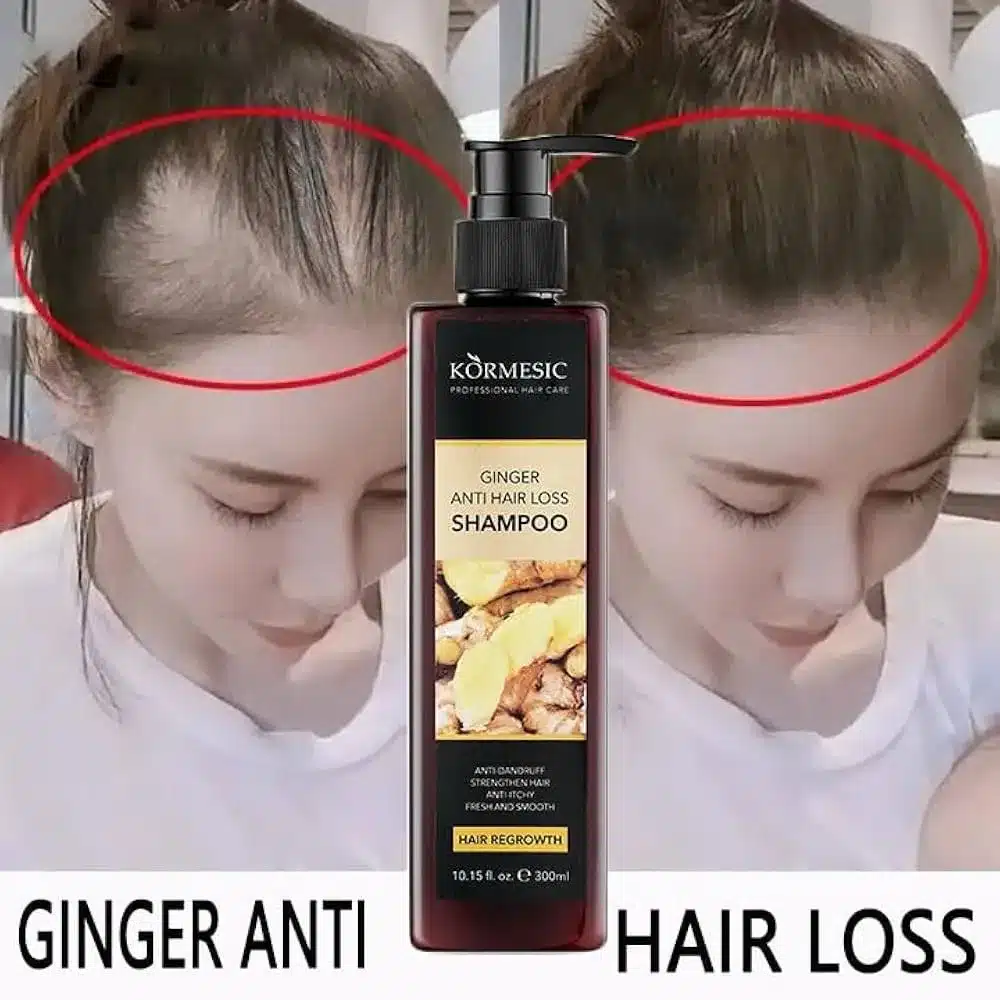 شامپو ضدریزش و تقویتی کورمسیک مدل جینسینگ حجم 300ml - تصویر 9