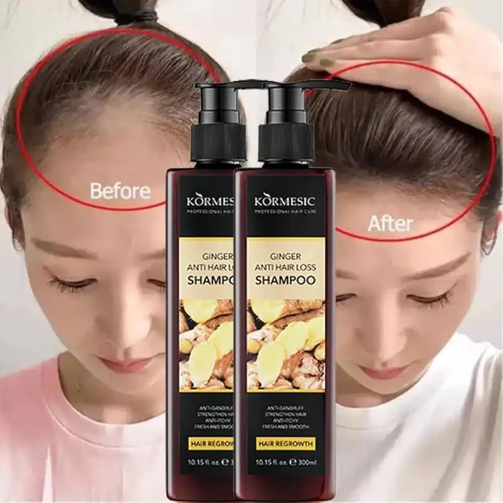 شامپو ضدریزش و تقویتی کورمسیک مدل جینسینگ حجم 300ml - تصویر 7