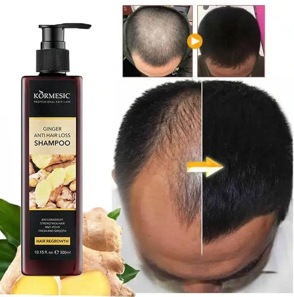 شامپو ضدریزش و تقویتی کورمسیک مدل جینسینگ حجم 300ml - تصویر 6